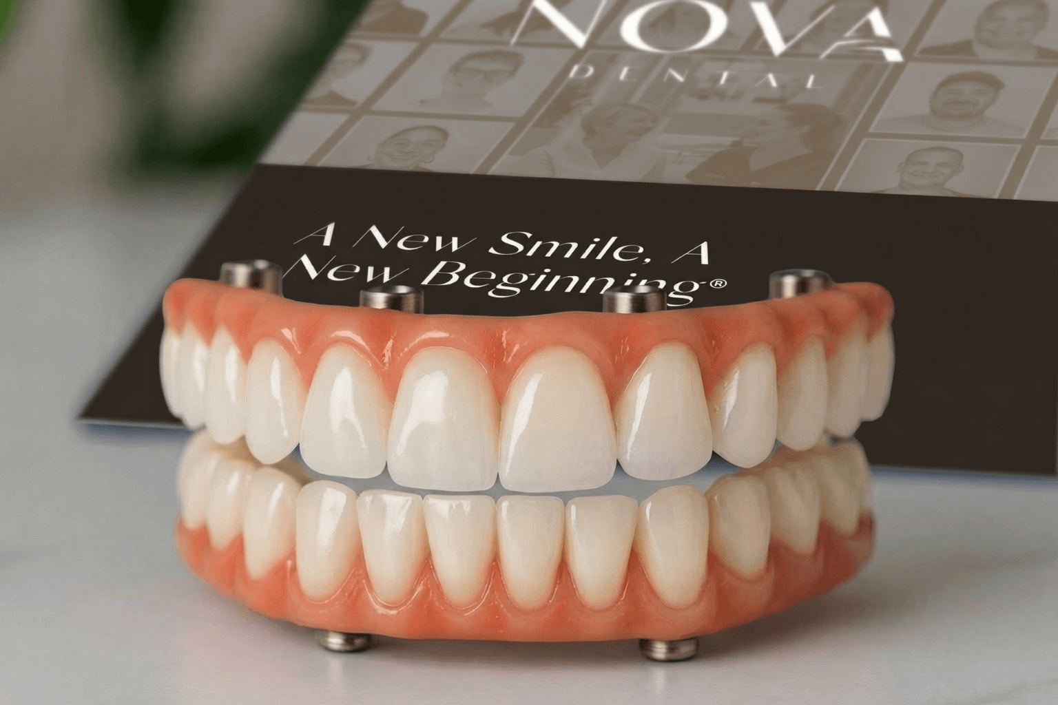 NOVA full arch dental implant smile